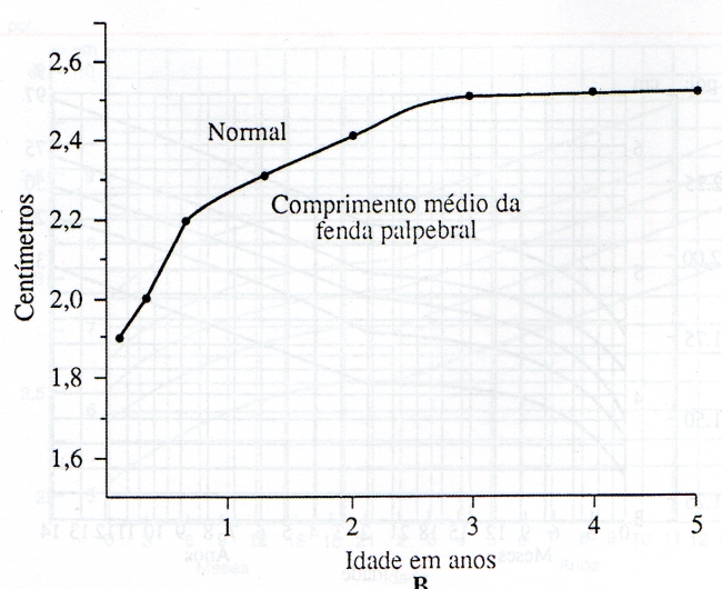 COMPRIMENTO DA FENDA PALPEBRAL - 0 A 5 ANOS DE IDADE